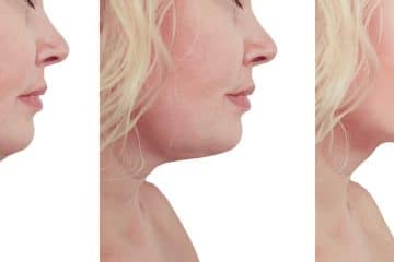 cfbdb6c86f634b74a08480690e69cdf9