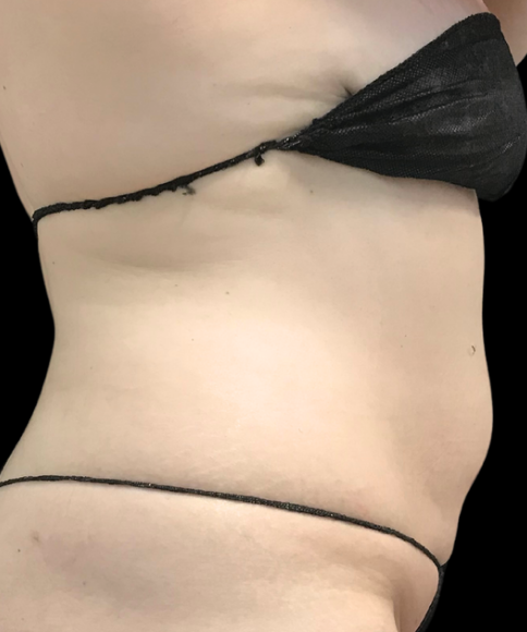 After Image: EON - right-side